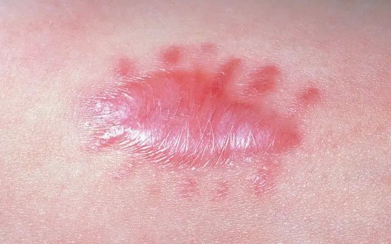 （示意圖源：互聯網） 