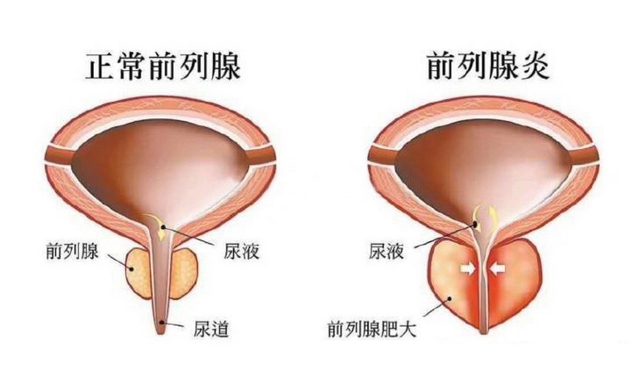 (示意圖源:互聯網)