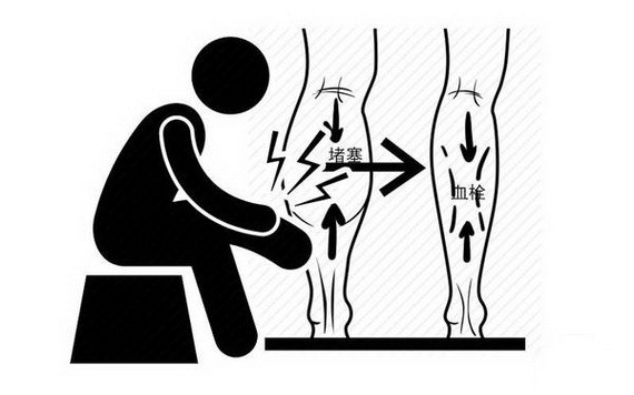（示意圖源：互聯網）