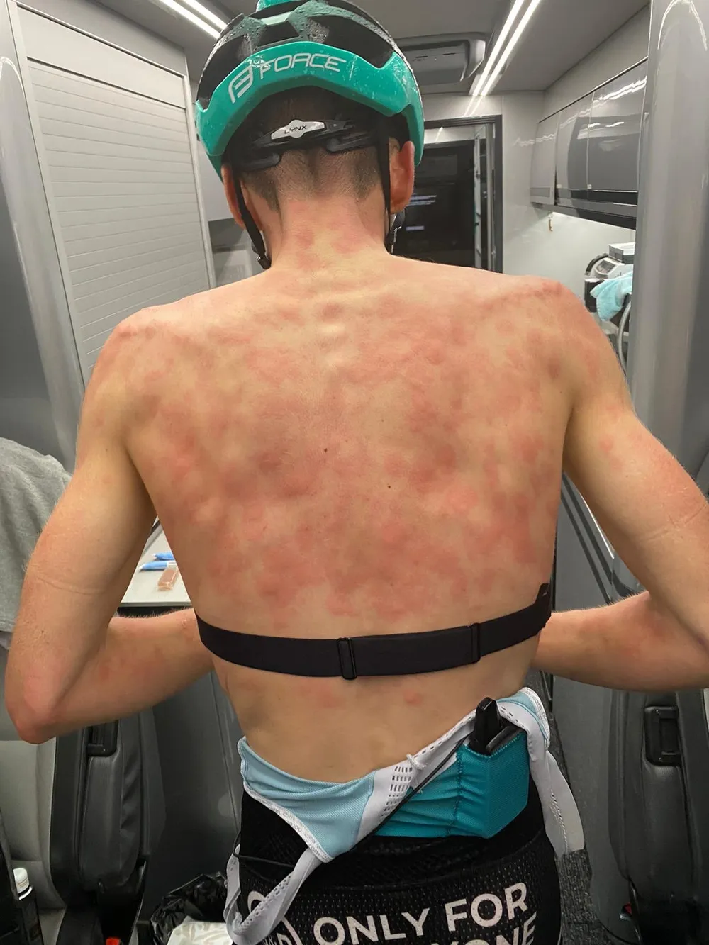 Criterium du Dauphine: Mưa đá bất ngờ ở chặng 2, một số tay đua sưng hết mình mẩy ảnh 2