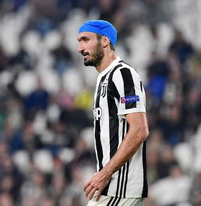 Chiellini băng kín đầu vẫn chơi đến hết trận. Ảnh: Getty Images.