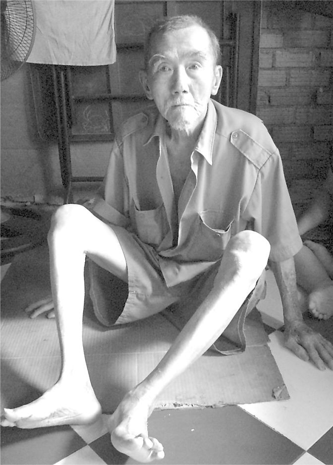 患肝癌老漢沒錢醫治