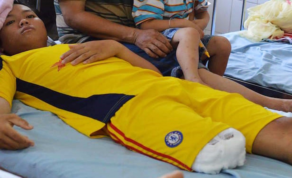 因由醫院處理不當，陳竹江上夾板後截肢三分之一。（圖源：互聯網）