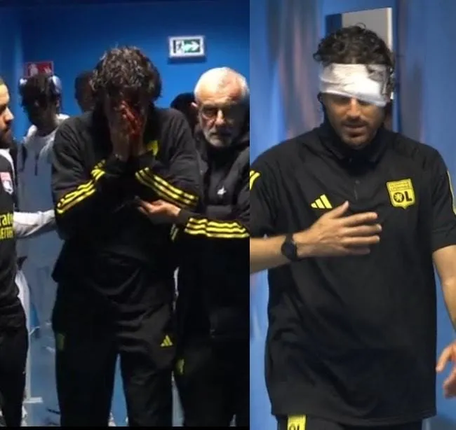 HLV Grosso sốc sau khi bị tấn công