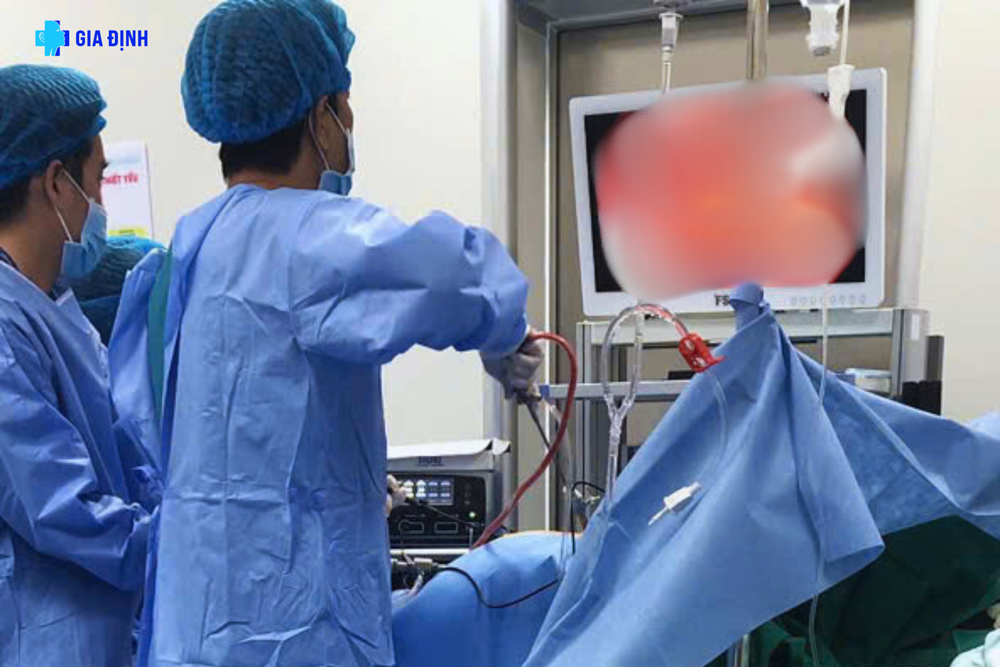 Doctors perform laparoscopic surgery on the patient. bs-chau-cung-ekip-phau-thuat-noi-soi-cho-nguoi-benh-3783-5029.png.png