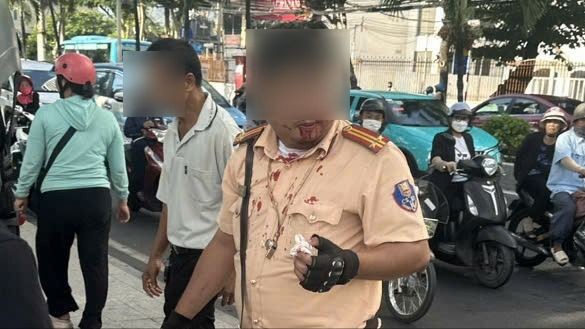 The traffic police officer is assaulted while on duty. z6883689678080-a5039a68e4e770bb3809d0af33fa375b-4342-2078.jpg.jpg