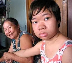 Dioxin - nỗi đau chưa ngưng…