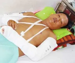 KCN Nhơn Trạch, Đồng Nai: 4 tháng, 3 vụ côn đồ chém bảo vệ