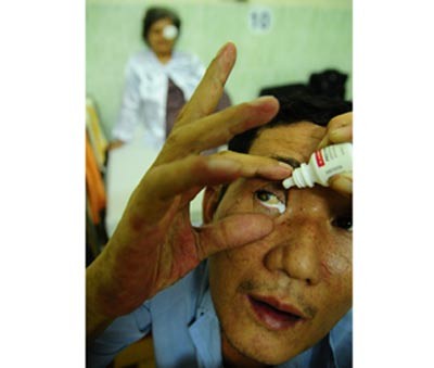 Patient Le Thanh Long in HCMC's ditrict 4 instils a drug into his eye under doctors' insutrction. He returns blinded after catarac surrgery at the HCMC Eye Hospital due to contaminated surgery aid (Photo: Tuoi Tre) Patient Le Thanh Long in HCMC's ditrict 4 instils a drug into his eye under doctors' insutrction. He returns blinded after catarac surrgery at the HCMC Eye Hospital due to contaminated surgery aid (Photo: Tuoi Tre)