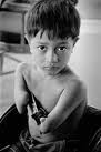 Children affected by Agent Orange need more aids Children affected by Agent Orange need more aids