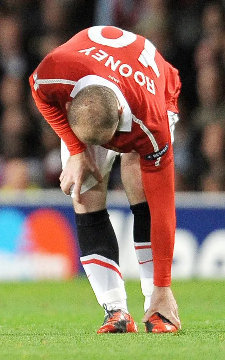 Wayne Rooney lại dính chấn thương mắt cá