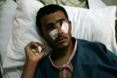AFP - A Yemeni tribesman loyal to tribal chief Sadiq al-Ahmar lies on a hospital bed in Sanaa after sustaining wounds in fighting. AFP - A Yemeni tribesman loyal to tribal chief Sadiq al-Ahmar lies on a hospital bed in Sanaa after sustaining wounds in fighting.