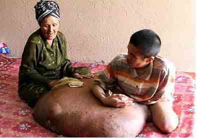 Hai with his mother, who takes care of him Hai with his mother, who takes care of him