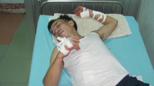 Shop owner Nguyen Huu Quang being treated at the local hospital for stab wounds (Photo: Tuoi tre) Shop owner Nguyen Huu Quang being treated at the local hospital for stab wounds (Photo: Tuoi tre)