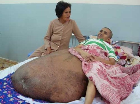 Hai with his mother Hai with his mother