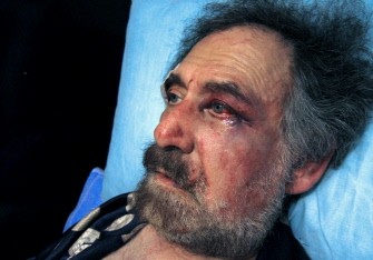 Wounded Syrian cartoonist Ali Farzat rests in bed at his residence in Damascus on August 25, 2011 Wounded Syrian cartoonist Ali Farzat rests in bed at his residence in Damascus on August 25, 2011