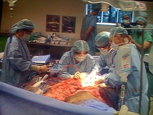 Surgeons performing the surgery to remove the gigantic 90 kg tumor (Photo: NLD) Surgeons performing the surgery to remove the gigantic 90 kg tumor (Photo: NLD)