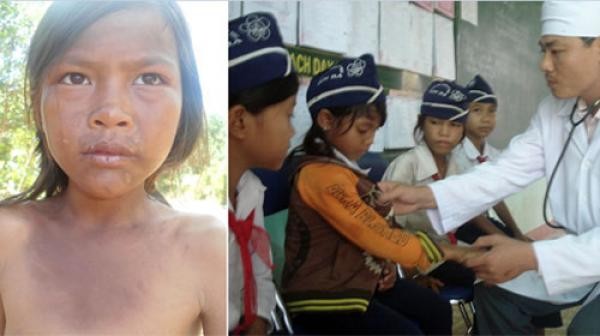 A medic examines bruises on students (Photo: Tuoi tre) A medic examines bruises on students (Photo: Tuoi tre)