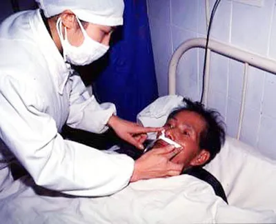 Trung Quốc đối mặt với dịch bệnh lao kháng thuốc