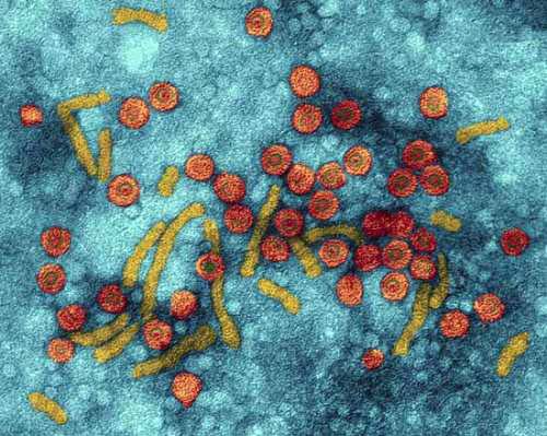 Hepatitis B virus Hepatitis B virus