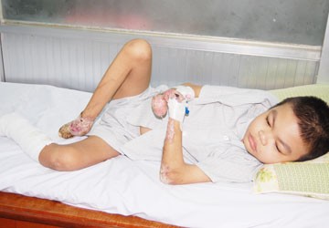 18 year old boy suffers from Vohwinkel syndrome; consequently, he can lose his limbs due to gangrene 18 year old boy suffers from Vohwinkel syndrome; consequently, he can lose his limbs due to gangrene