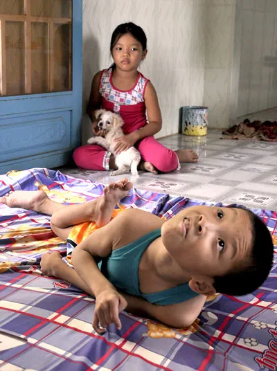 Đồng cảm với nỗi đau (nạn nhân bị nhiễm chất độc da cam ở huyện Bình Chánh, TPHCM).