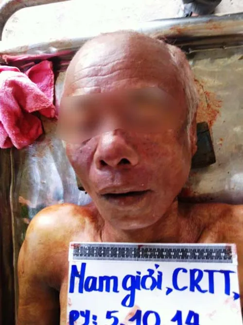 Công an quận Bình Tân truy tìm tung tích nạn nhân