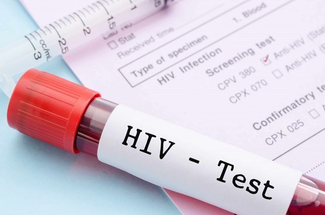 Illustrative Image (Source: At Home STD Tests) Illustrative Image (Source: At Home STD Tests)