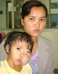 “Cánh tay nâng những cuộc đời” ảnh 4 “Cánh tay nâng những cuộc đời” ảnh 4
