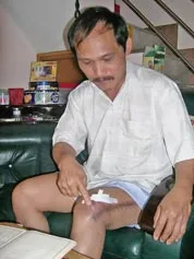 Bác sĩ bỏ quên… gạc trong người bệnh nhân