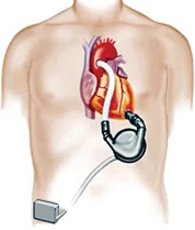 Những phát minh độc đáo ảnh 6 Những phát minh độc đáo ảnh 6