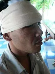 Đánh người trọng thương, vẫn ung dung ảnh 2 Đánh người trọng thương, vẫn ung dung ảnh 2