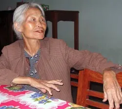 Bài 1: Vết sẹo thành rãnh trên thái dương