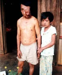 Một phán quyết vô nhân đạo