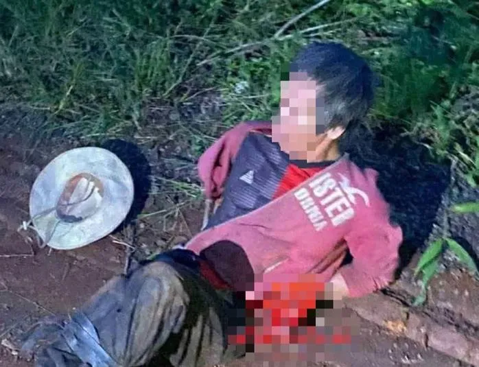 Anh S. bị một người đàn ông có dấu hiệu tâm thần tấn công, phải nhập viện trong tình trạng nguy kịch. Ảnh: Người dân cung cấp base64-17573816919082021544130.jpg