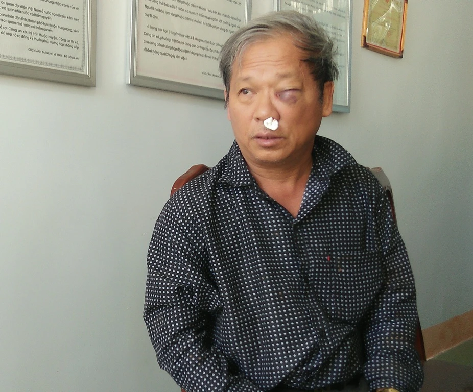 Phóng viên bị đánh dã man sau khi báo tin khai thác đất trái phép ảnh 1 Phóng viên bị đánh dã man sau khi báo tin khai thác đất trái phép ảnh 1