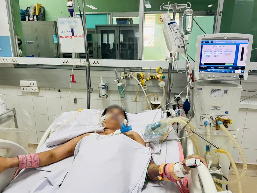 Bệnh nhân H.T.M khi đang điều trị tại Bệnh viện Bệnh nhiệt đới TPHCM 529896074_1227909705803205_9077873164372464199_n.jpg