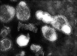 Các chủng virus cúm ở người tăng nhanh độ kháng thuốc