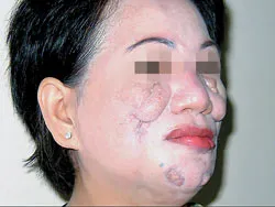 Bài 1: Chết vì... thiếu hiểu biết! ảnh 2 Bài 1: Chết vì... thiếu hiểu biết! ảnh 2