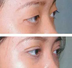 Làm đẹp “cửa sổ tâm hồn” ảnh 2 Làm đẹp “cửa sổ tâm hồn” ảnh 2
