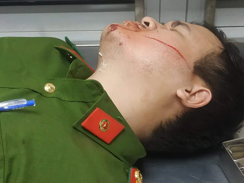 Hai chiến sĩ công an bị thương khi ngăn đối tượng bị bệnh tâm thần đe dọa giết người  ảnh 2