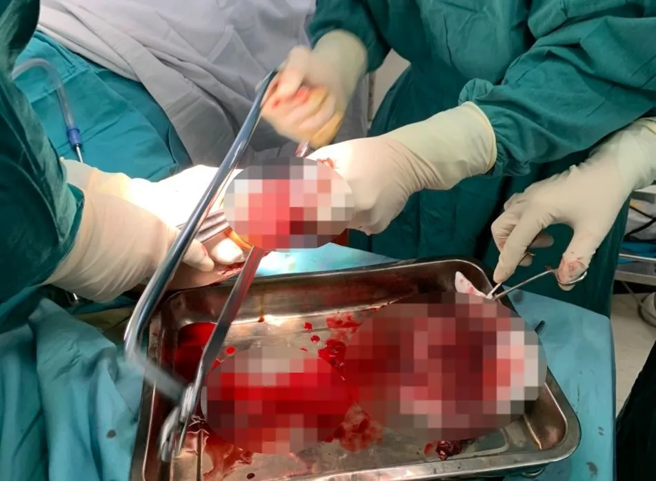 Các y bác sĩ phẫu thuật điều trị cho nạn nhân Các y bác sĩ phẫu thuật điều trị cho nạn nhân