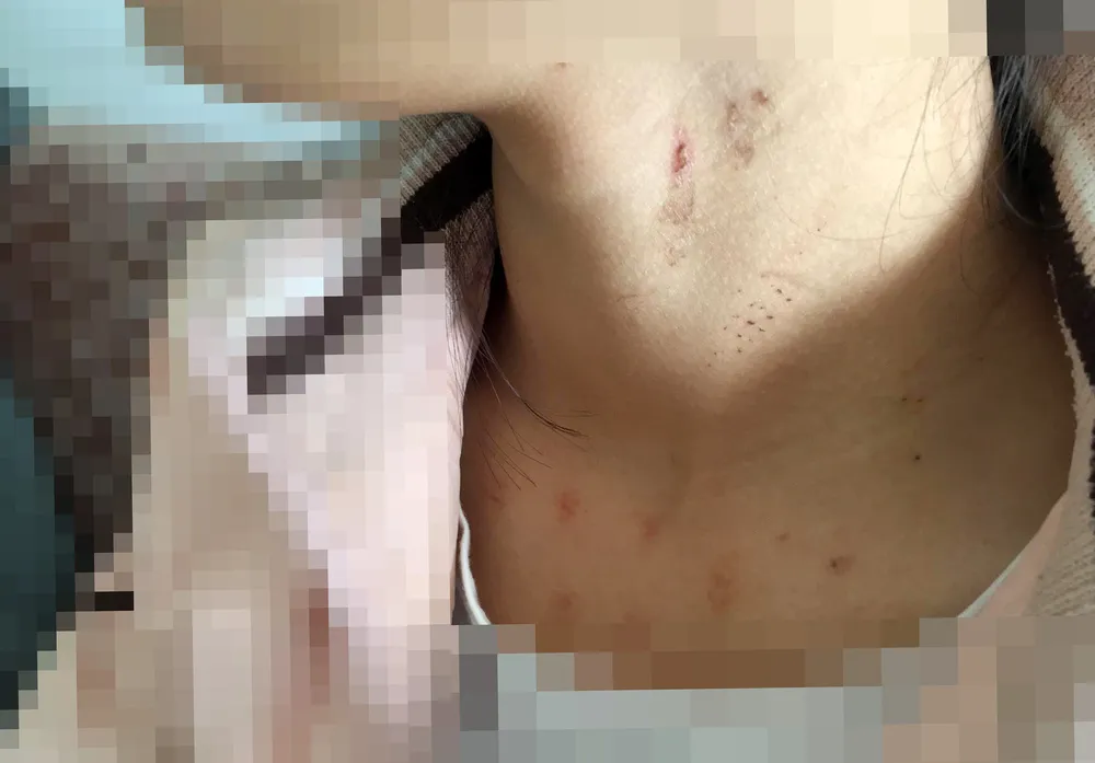 Công an truy tìm thủ phạm chặn xe, cưỡng hiếp nữ sinh lớp 10 ảnh 1