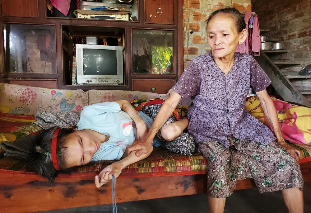 Bà Học đang chăm sóc người con gái bị bại não, nằm liệt giường Bà Học đang chăm sóc người con gái bị bại não, nằm liệt giường