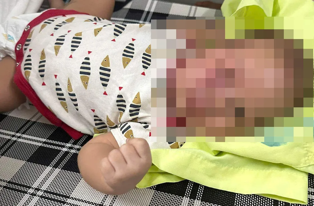 Hình ảnh cháu bé bị đánh đập bầm tím được đăng tải trên mạng xã hội thu hút nhiều người xem. Ảnh cắt từ Facebook z5914710485602_352de2898cb8d3a85203bfef41664804.jpg