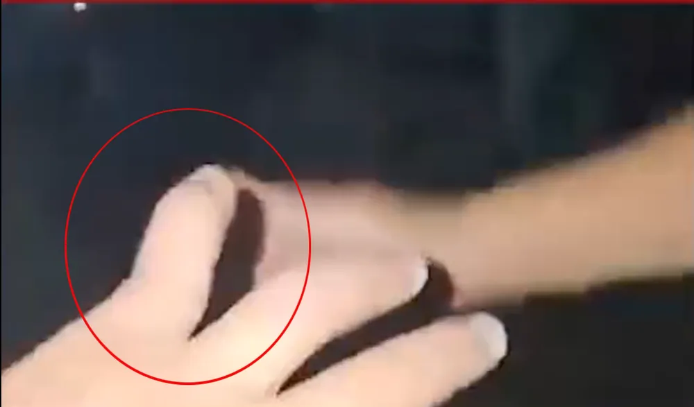 1 vị khách bị đánh lệch gãy ngón tay út (Ảnh cắt từ clip) Screenshot 2025-05-27 111004.png