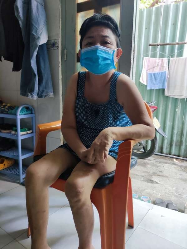 潘美鸞的右邊身無力，生活不能自理。