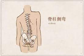 青少年做好5點保護好脊柱