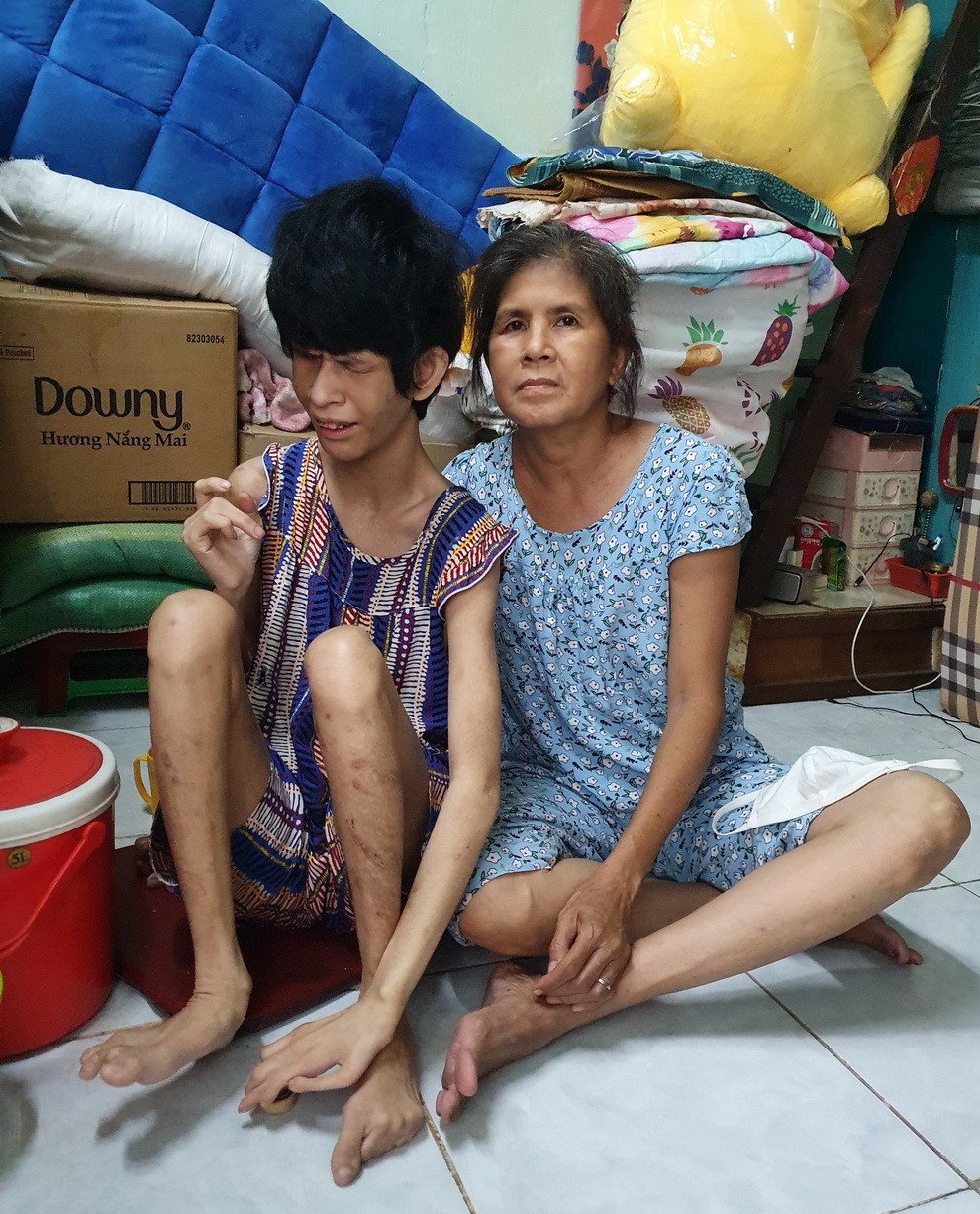 患上心臟病的駱家寶每天都要照顧生活不能自理的女兒。