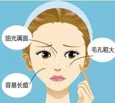 4種膚質很常見